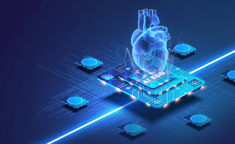 AI ECG