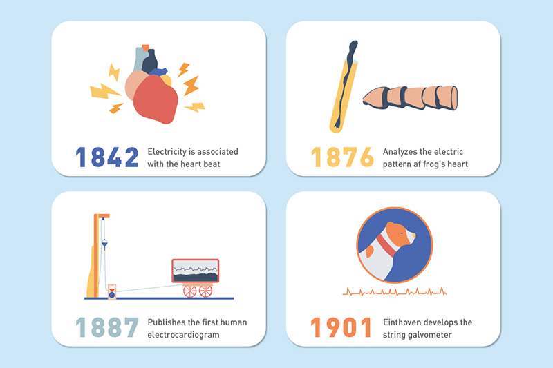 The History of ECG monitoring