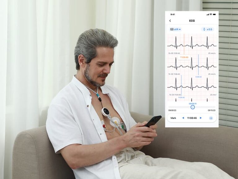 check ECG on phone